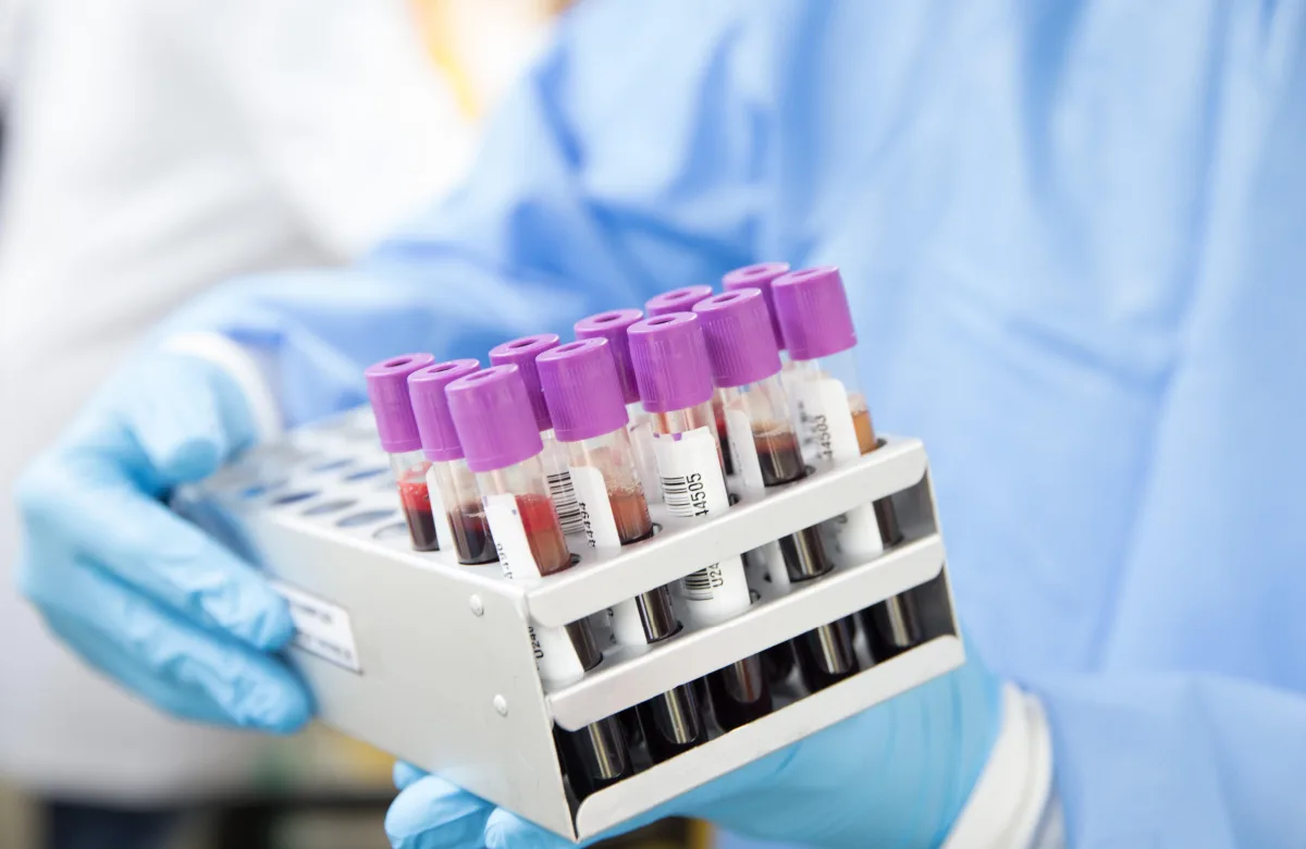 Hematología Benigna