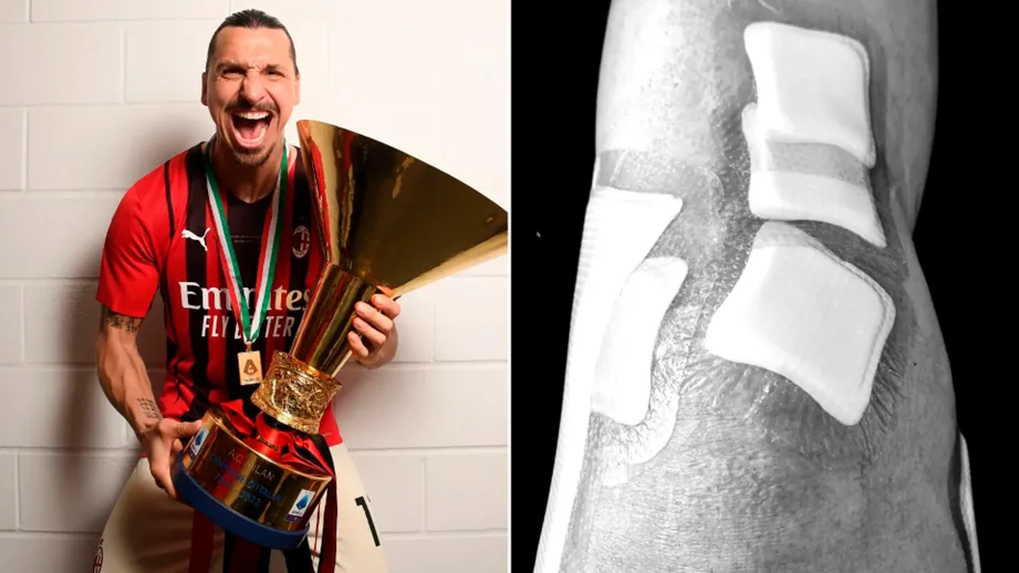 Lesión Zlatan