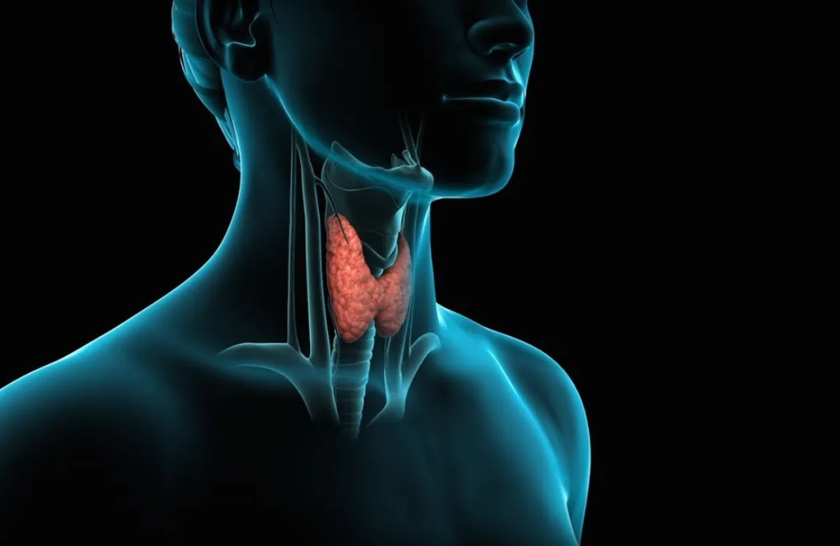 cáncer de tiroides